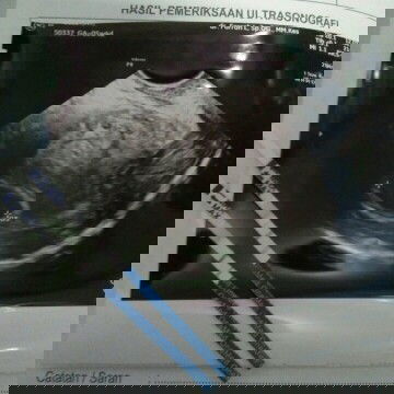 Pengalaman menanti kehadiran si buah hati #ibujuara