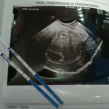 Pengalaman menanti kehadiran si buah hati #ibujuara