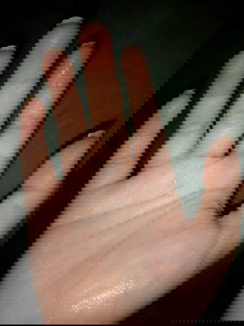 ควรไปหาหมอไหม