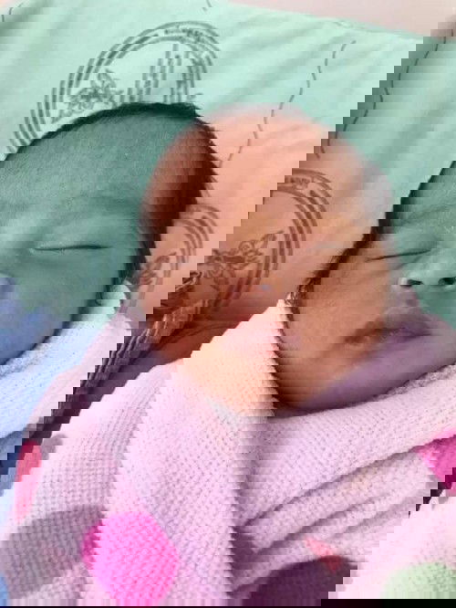 คลอดก่อนกำหนด