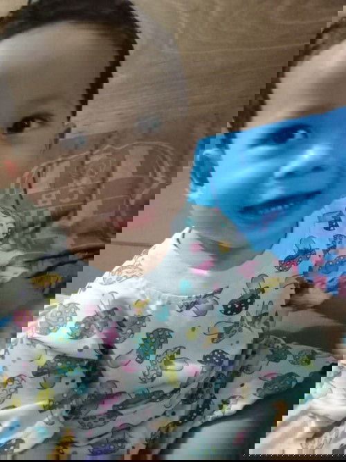 Harus terapi atau tidak