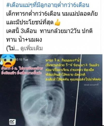 เตือนให้แม่ๆระวังกันน่ะค่ะ