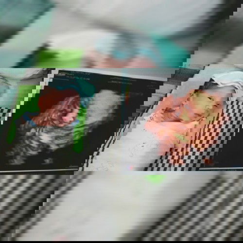 Drama Lahiran Normal Induksi karena Lewat HPL 14 Des 2020