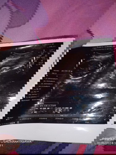 Siang bun maaf mw tny utk hasil usg sy it mksdtnya gmn y bun siapa tau bund2 dsni ad yg tau🙏
