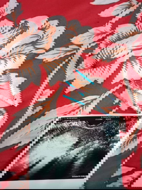 Perkiraan usia hpht 5w