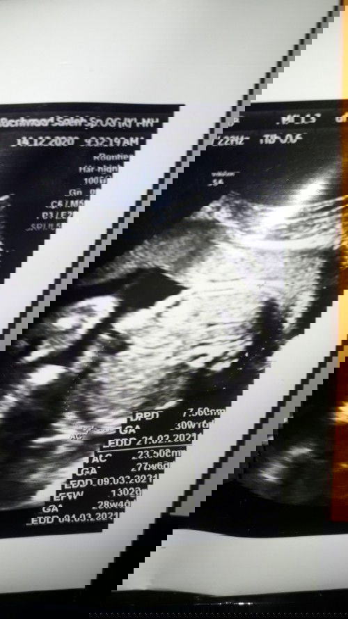 Hamil 28minggu 4 hari janin ukuran 23,50cm apakah normal???