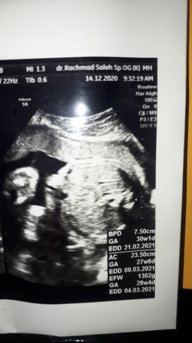 Hamil 28minggu 4 hari janin ukuran 23,50cm apakah normal???