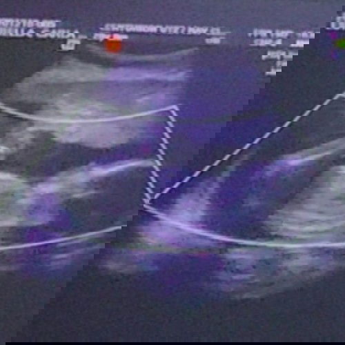 The Gender is finally out