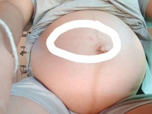 ท้องเดินชนประตู