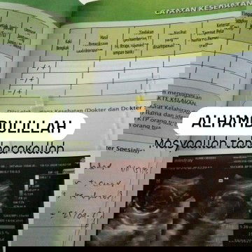 Bbj 23week hpl april