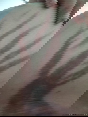 Các mom có ai bị giống em không ạ và có cách nào để hết không các mom chỉ em với