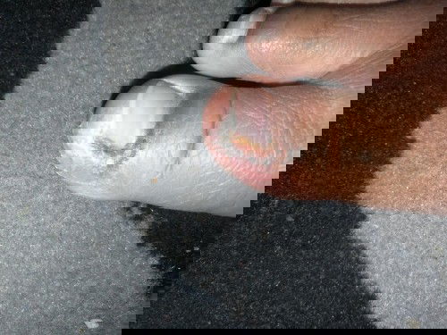 Ini kaki saya kenapa ya? Cara mengobati nya gmna mom?