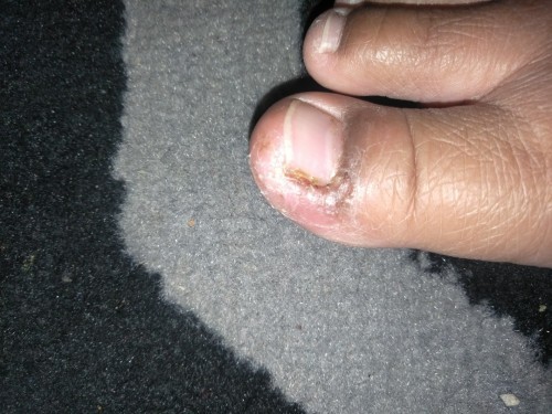 Ini kaki saya kenapa ya? Cara mengobati nya gmna mom?