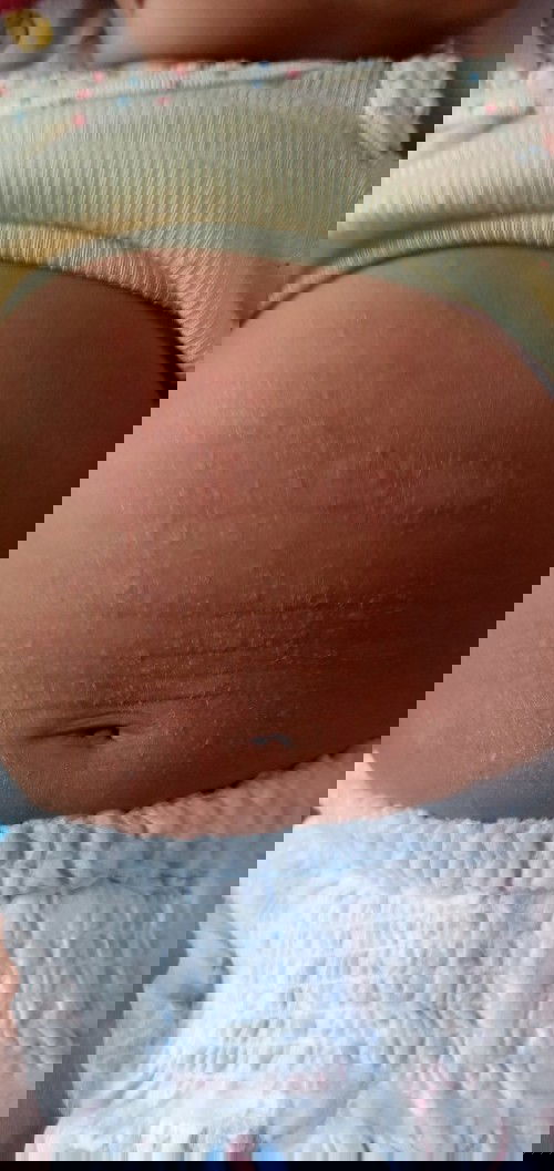 Perut baby umur 3 bln