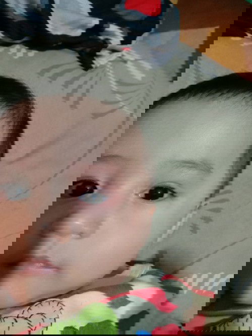 Cara mengatasi si bayi yg sering ngucek mata ...#serius nanya nih  bund?