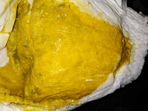 ลูก3เดือน11วัน อึมีมูกใส นมแม่ล้วน