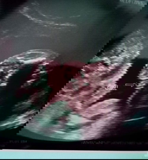 20 weeks 5 days scan 
(19 Dec 2020)