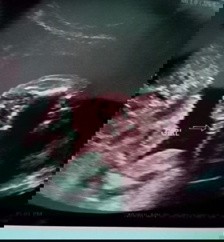 20 weeks 5 days scan
(19 Dec 2020)