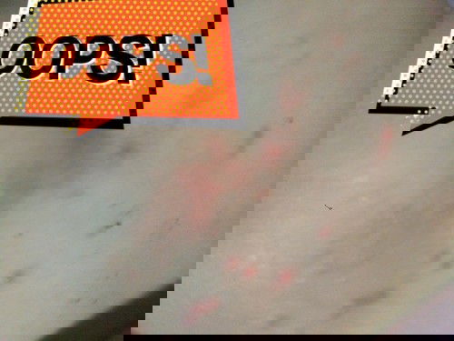 ruam popok atau yang lain?