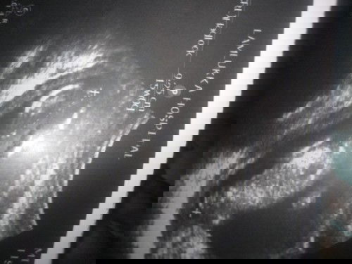 กังวลลูกตัวเร้ก