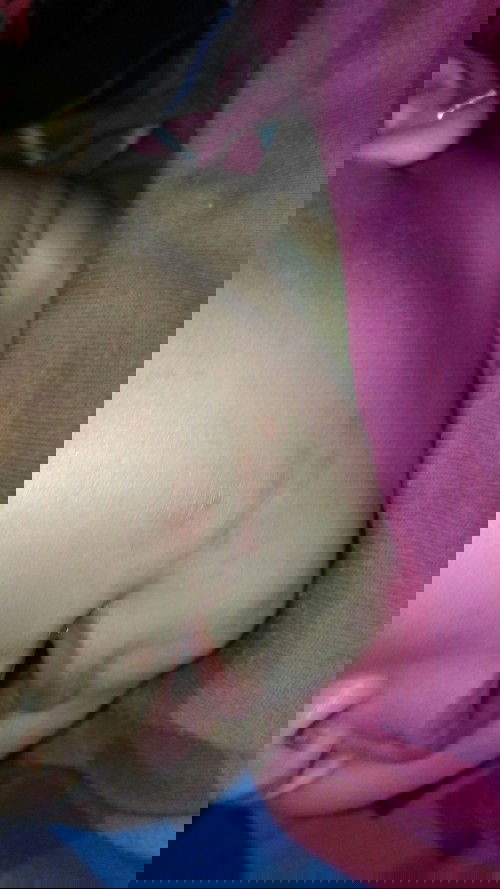 Bintik Merah di Pipi