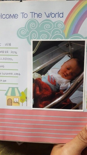 CERITAKU MELAHIRKAN DENGAN NYAMAN DAN MINIM TRAUMA DENGAN KASUS KETUBAN PECAH DINI/KPD (#IBUJUARA)