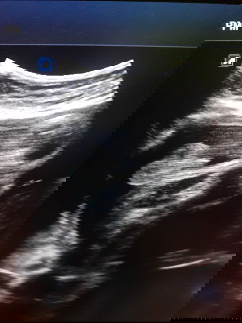 ซาวย์ เพศชายจ้า