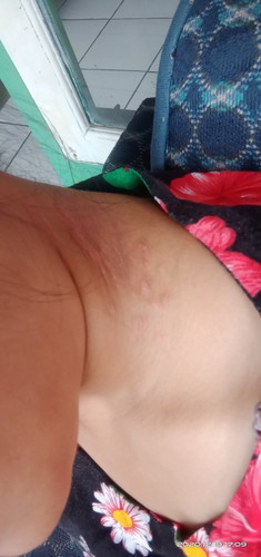 Bund saya mau taya dong sya mengalami gatal" bagian leher minum obat sma salep tpi blm ada peruhan?