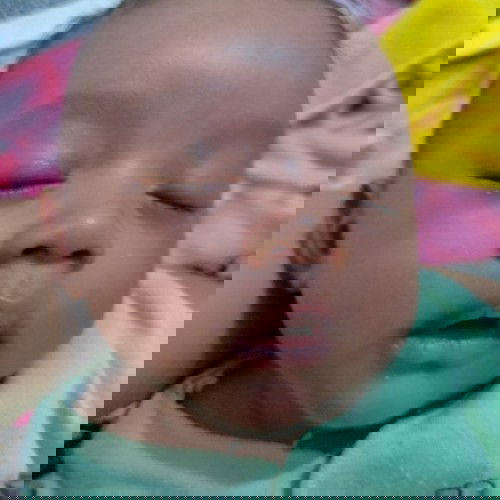 Bibir kering pecah-pecah