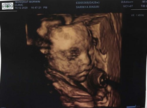 หนุ่มน้อย
28w เเล้วครับบ