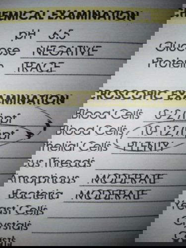UTI mataas po ba?