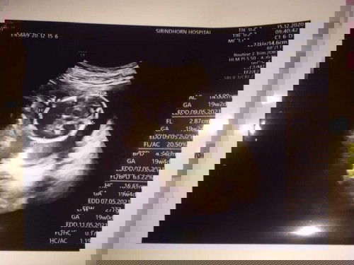 คือส่วนไหนบ้างคะ ดูไม่ออกเลยคะ 🤣