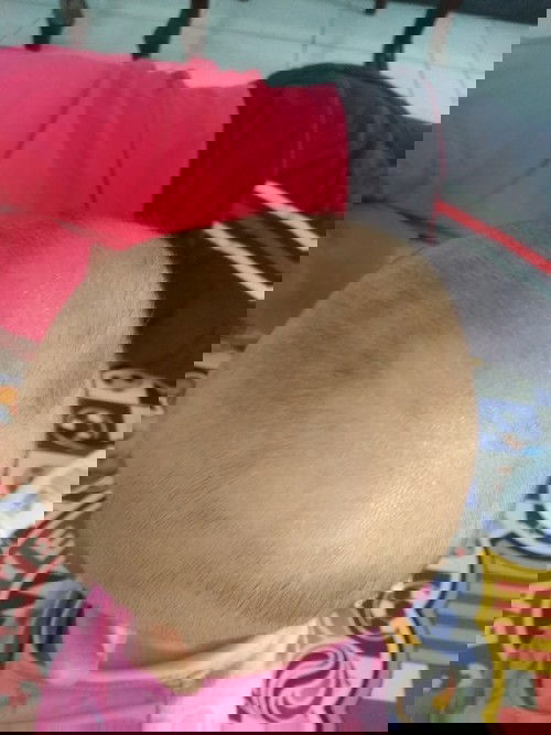 Solusi ketombe pada bayi