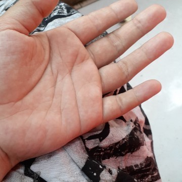 Tangan mati rasa.