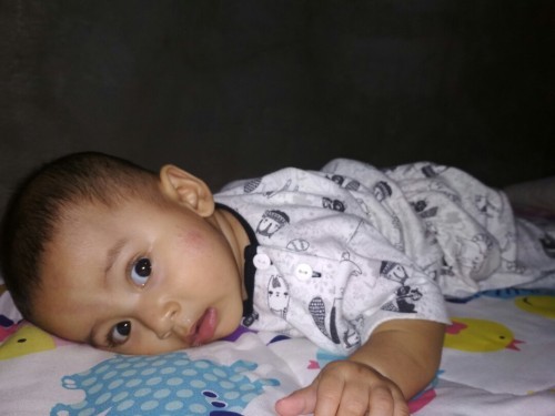 tolong dong bund solusi untuk menghilangkan ruam susu pda bayi gmn ya? kok makin lma makin melebar.