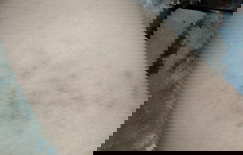 สอบถามค่ะ หลังคลอดหายมั้ยคะ