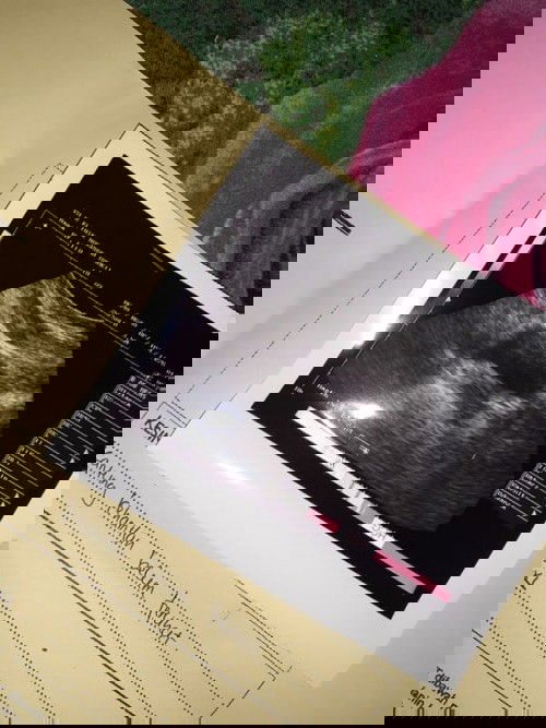 Assalamualaikum bunda
Sy mau bertanya saya tlat haid sekitar 3 minggu lalu tespek hasil nya garis 2