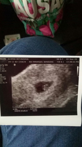 cerita kehamilan + kelahiran anakku💕 #ibujuara