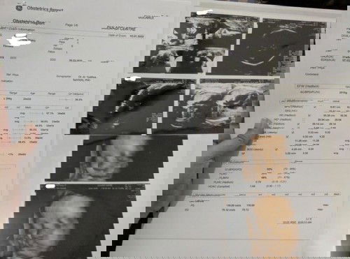 dibalik anak yang spesial ada ayah dan #ibujuara