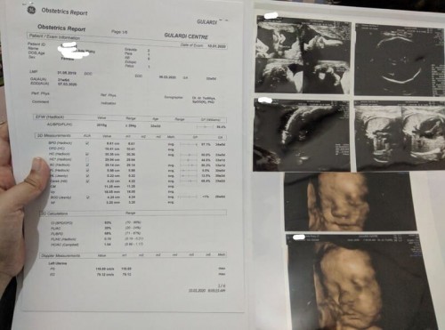 dibalik anak yang spesial ada ayah dan #ibujuara