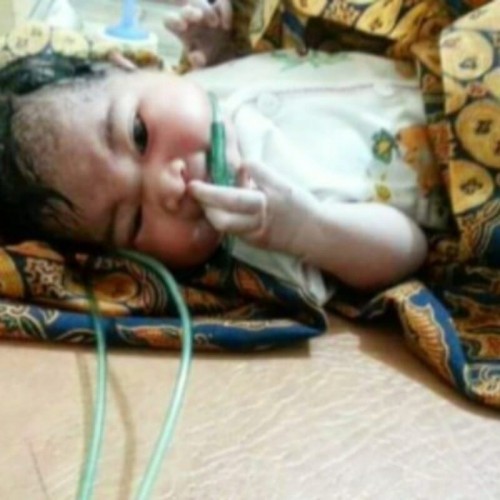 Kekuatan anak  ada pada ibu yang kuat , berjuanglah nak !!