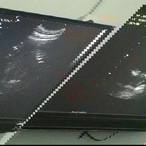 #IBUJUARA

Surat cinta untukmu cantik ku ❤️