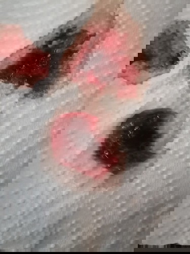 Bleeding..