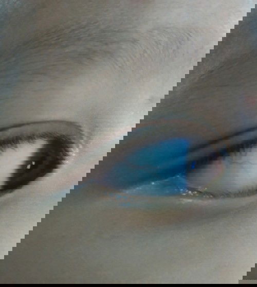 Garis Merah pada Mata Bayi