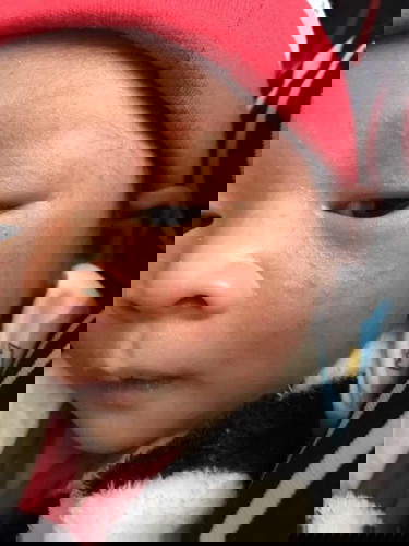 หน้าน้องเป็นผื่น ทำยังไงดีคะ