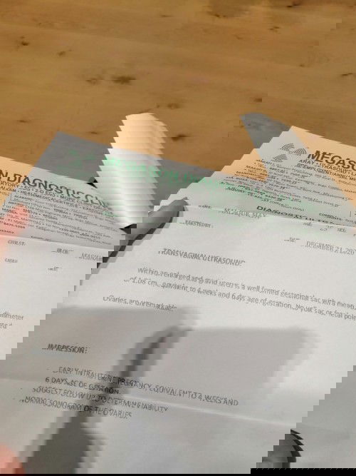 4 weeks & 5days ultrasound no yolk sac and fetal pole