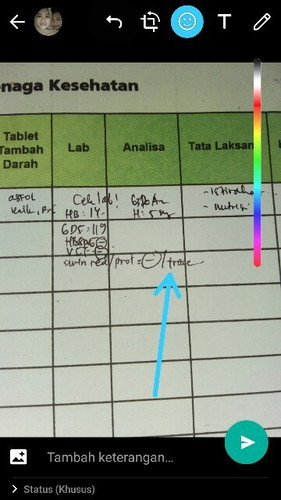 Urine trace