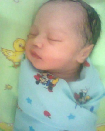 Berat Badanku Turun Drastis Saat Aku Hamil Karena Hyperemesis Gravidarum #IBUJUARA