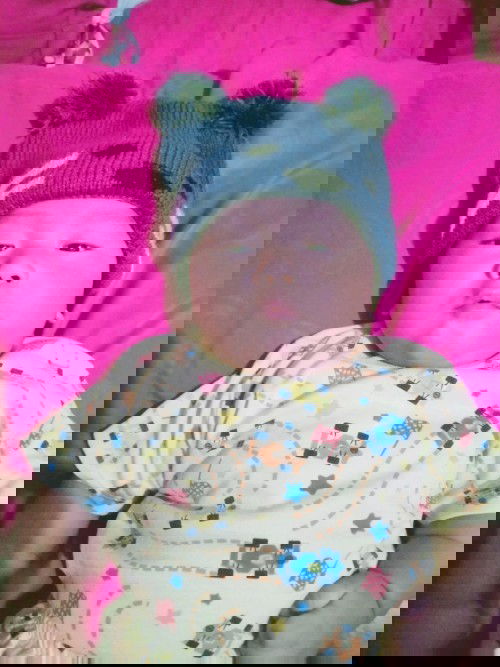 Bayi 4 bulan belum bisa tengkurap sendiri