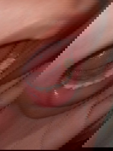 Anak sakit ibu galau #ibujuara